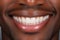 Close-Up of a Radiant Black Mans Perfect Smile - Captivating with White Teeth, Exuding Luxury