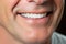 Close-up of a Radiant Smile. Senior Man with Pristine Teeth after a Visit to the Dentist