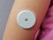 Close up of sensor on hand for device for continuously glucose monitoring in  blood â€“ CGM.. Insulin depend. Diabetes type 1