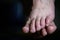 Close up of shamed woman hiding her altlete`s foot fungus infection