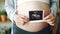 Close-up shot of pregnant woman`s belly and female hands holding ultrasound image of healthy unborn child. Pregnancy