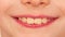 Close-up smile of the lips and teeth of a Caucasian boy of school age. A 7-year-old boy smiles sincerely. Macro. Details of a part