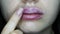 Close-up of swollen lips after injections of hyaluron, lip augmentation