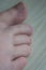 Close up of toes with uncut growing toenails and some hair on bigtoe. Small female foot with dirty toenails and bruised toe from