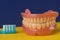 close-up of a toothbrush and removable dentures on a blue background. theme of dental care and removable prostheses. dental