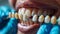 Close-Up View of Dental Examination and Teeth Cleaning by Dentist