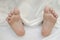 Close up view of men feet isolated on white sheet background laying on bed. Peeling flaky dry.