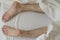 Close up view of men feet isolated on white sheet background laying on bed. Peeling flaky dry.