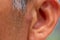 Close-up view of nodular acne in front of Asian elderly man ear