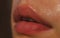 Close-up of wet nature lips. Lips with gloss makeup. Filler Injections, Plastic Surgery, Collagen and Treatments.