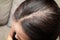 Close up of white hair in asian woman. common problem of woman