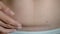Close-up of woman belly with a scar from a cesarean sec