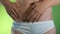 Close-up of woman belly with a scar from a cesarean section.