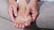 Close-up of a woman massage painful toes at home. Bare foot of woman with painful red bunion Hallux valgus and injury foot, Prob