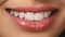 Close up woman smile. Teeth whitening. Dental care