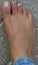 Close up of women`s foot isolated on a concrete floor background. Foot is ugly, dark brown and it has hair and veins showing. No