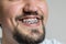 Close up of a young man with braces smiling. Macro shot of a young man with braces on a white background