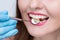 Close-up of young woman at dental visit