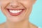 Closeup Of Beautiful Smile With White Teeth. Woman Mouth Smiling