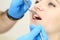 Closeup of beautiful who woman undergo dental procedures. Selective focus