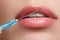 Closeup of beautiful woman gets injection in her face. Full lips. Beautiful face and the syringe plastic surgery and cosmetic