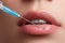 Closeup of beautiful woman gets injection in her lips. Full lips. Beautiful face and the syringe (plastic surgery and cosmetic inj