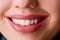 Closeup Beautiful young woman smile. Dental health. Teeth whitening.  Restoration concept.