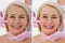 Closeup before after Beauty middle age woman face portrait. Before-after Spa anti wrinkled aging female body parts concept. Mid-