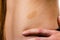 Closeup of brown birthmark on skin