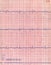 Closeup cardio diagram, pacient heart test,