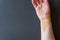 Closeup of colorful bruises on the injured wrist of a caucasian woman