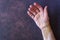 Closeup of colorful bruises on the injured wrist of a caucasian woman