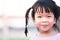 Closeup, cute Asian girl sweet smile. Little kid lips peeled and dehydrated from drinking less water. Child braided pigtails.