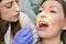 Closeup, dentist checking young woman braces