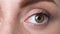 Closeup of female blinking, suffering dry eye syndrome, vision problems fatigue