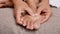 Closeup of female holding her painful feet and massaging her bunion toes to relieve pain. Swollen bunion at the edge of the big to