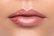 Closeup of female lips affected by herpes virus