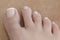 Closeup foot of a woman