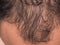 closeup of hair lose