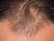 closeup of hair lose