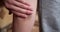 Closeup of hands applying balm to leg. Knee injury, skin hematoma, skin repair concept. slow motion
