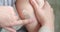 Closeup of hands applying balm to leg. Knee injury, skin hematoma, skin repair concept. slow motion