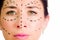 Closeup headshot caucasian woman with dotted lines drawn around face looking into camera, preparing cosmetic surgery