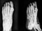 Closeup image of classic xray image of feet. Black and white.