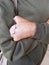 closeup left hand of asian old man suffering from leprosy, Thailand. Horizontal photo