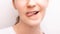 closeup lower part of naughty teen girl face, open mouth with brackets showing tongue on white background
