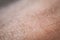 Closeup macro skin texture. Healthy caucasian skin