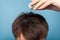 Closeup of male hand applying medications on brunette male hair. indoor studio shot isolated on blue background