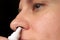 Closeup of middle aged woman dripping nasal drops in nose. Female sprays at home to treat cold, flu or allergy. Health care