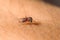 Closeup mosquito suck blood on skin